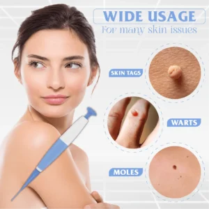 SkinTag Auto Micro PainlessRemover Kit