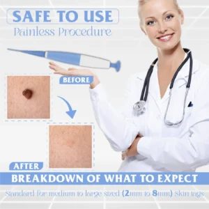 SkinTag Auto Micro PainlessRemover Kit
