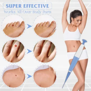 SkinTag Auto Micro PainlessRemover Kit