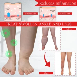 SwellDetox Ginger FootPatch