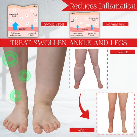 SwellDetox Ginger FootPatch
