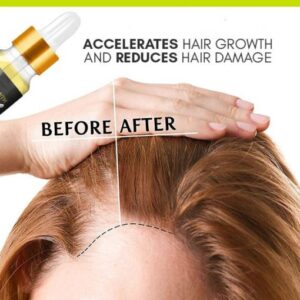 Biotin Thickening Herbal Serum