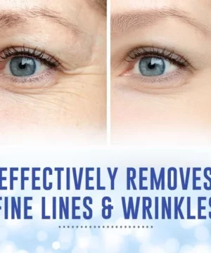 Wrinkle Remover Microneedle Eye Mask