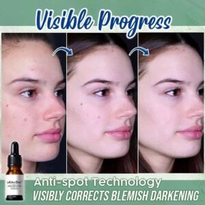 ActiveSkin Mole Removal Serum