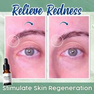 ActiveSkin Mole Removal Serum