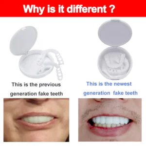 Adjustable Snap-On Dentures