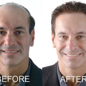 Anti-Hair Loss Rice Shampoo Bar