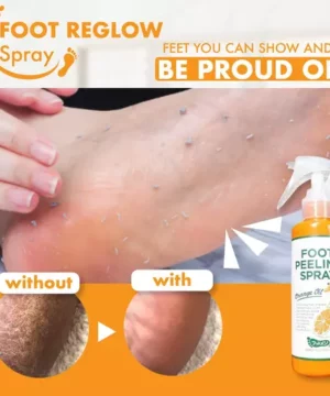 Callus Off Foot Reglow Spray