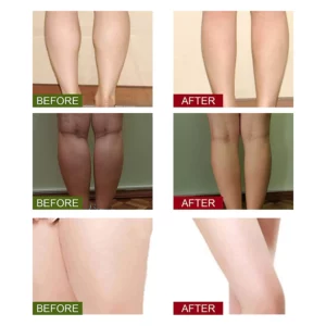 Lympathic Detoxification Foot Soak Package