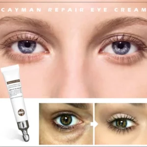 MAGIC EYE CREAM