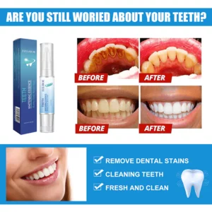 Mintsincerely Teeth Whitening Pens