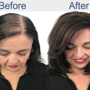 OriginPro Anti-Hair Loss Rice Shampoo Bar