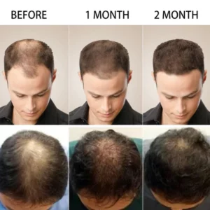 OriginPro Anti-Hair Loss Rice Shampoo Bar