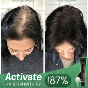 Regrowth Organic Hair Serum Roller