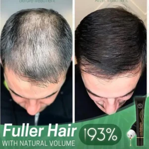 Regrowth Organic Hair Serum Roller