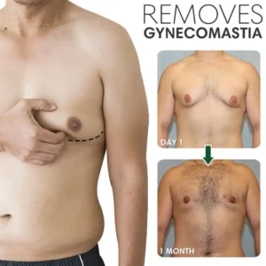SoliPac Gynecomastia Reduction Ointment