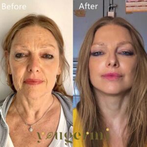 Collagen Boost Anti-Aging Serum