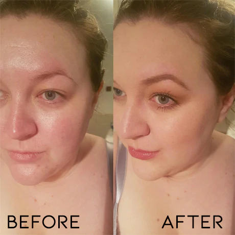 EMS Facial Lift Rejuvenation Kit