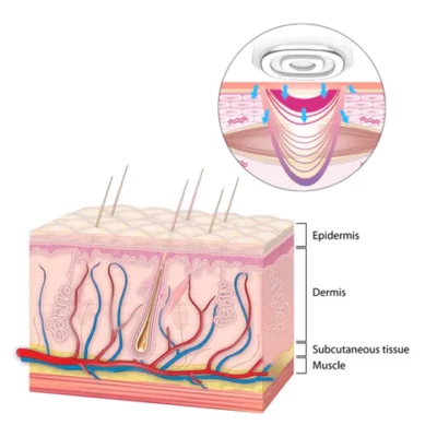 EMS Facial Lift Rejuvenation Kit