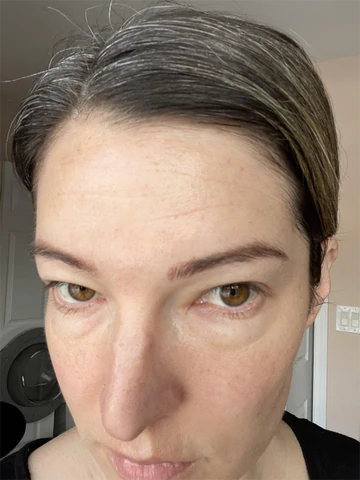 Ionic Eye Contouring System