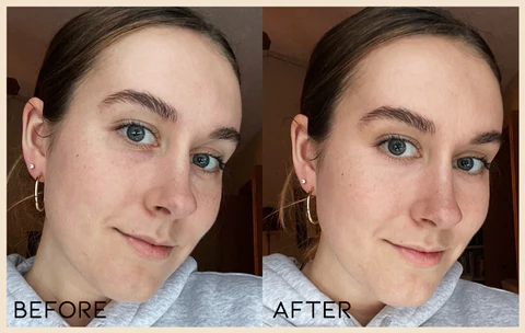 Ionic Eye Contouring System