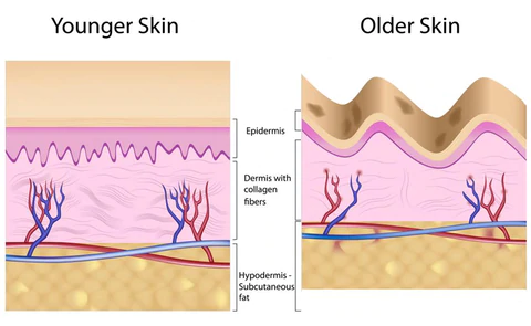 Ionic Eye Contouring System