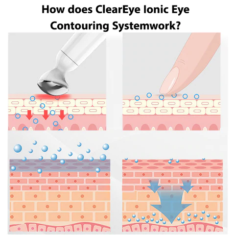 Ionic Eye Contouring System