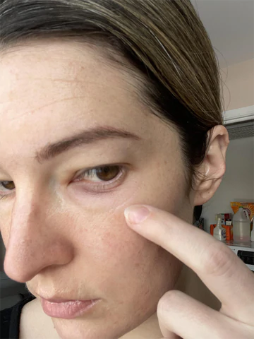 Ionic Eye Contouring System