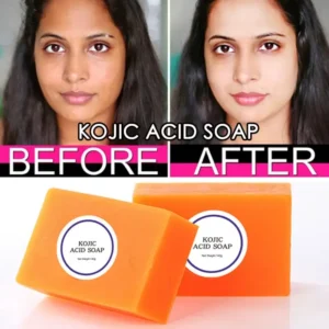 Kojic San Skin Lightening Soap