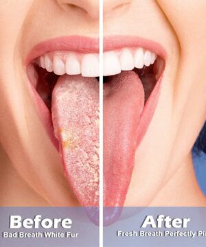 Tongue Cleaning Gel