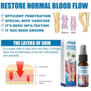 Varicose Veins Miracle Spray
