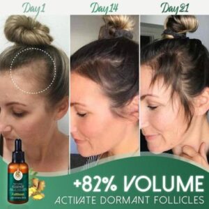 FolliBoost Hair Growth Serum