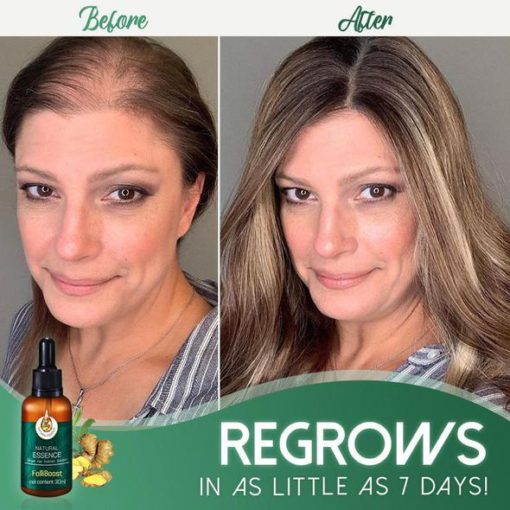 FolliBoost Hair Growth Serum