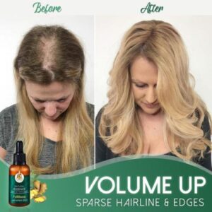 FolliBoost Hair Growth Serum