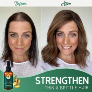 FolliBoost Hair Growth Serum
