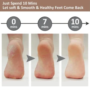 Rechargeable Electric Foot Callus Remover