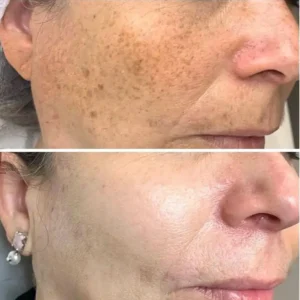Turmeric Dark Spot Corrector Serum – Fast Acting Serum