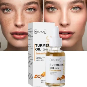 Turmeric Dark Spot Corrector Serum – Fast Acting Serum