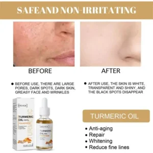Turmeric Dark Spot Corrector Serum – Fast Acting Serum