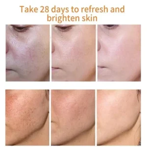 Turmeric Dark Spot Corrector Serum – Fast Acting Serum