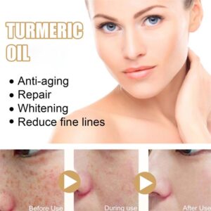 Turmeric Dark Spot Corrector Serum – Fast Acting Serum