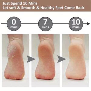2022 LATEST ELECTRIC FOOT FILE HARD SKIN REMOVER