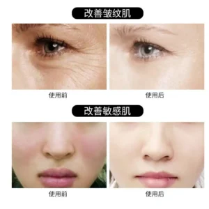Anti-Aging Collagen Silk Ball
