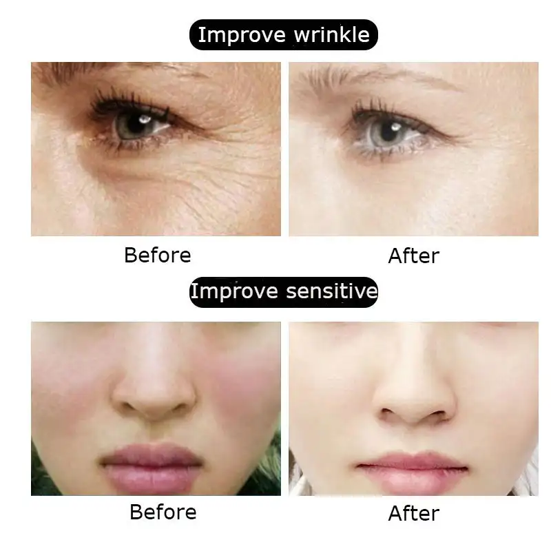 Collagen-X™ Anti-Aging Soluble Collagen Silk Ball