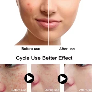 FRECKLE WHITENING CREAM