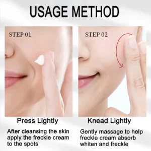 FRECKLE WHITENING CREAM