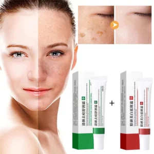 FRECKLE WHITENING CREAM