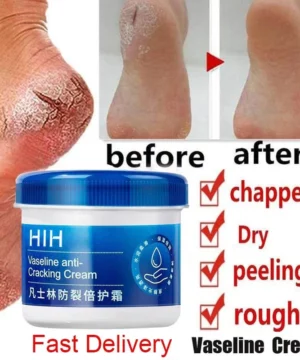 Foot Cream Vaseline Anti-cracking Moisturizing Foot and Hand Cream Beauty