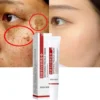 Freckle Whitening Cream