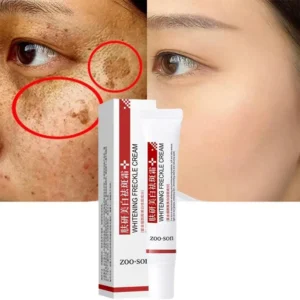 Freckle Whitening Cream